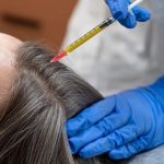 Affordable GFC Hair Treatment Cost: What to Know at the Best Skin Care Clinic in Chennai