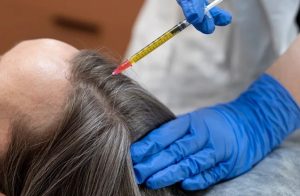 Affordable GFC Hair Treatment Cost: What to Know at the Best Skin Care Clinic in Chennai