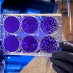 Stem Cells and Inflammation: How Mesenchymal Stem Cell Therapy Targets the Root Cause of Chronic Pain in Florida